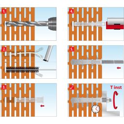 TOX kit de fixation pour 5